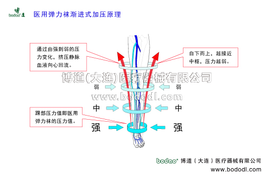 深靜脈血栓形成的預(yù)防與護(hù)理