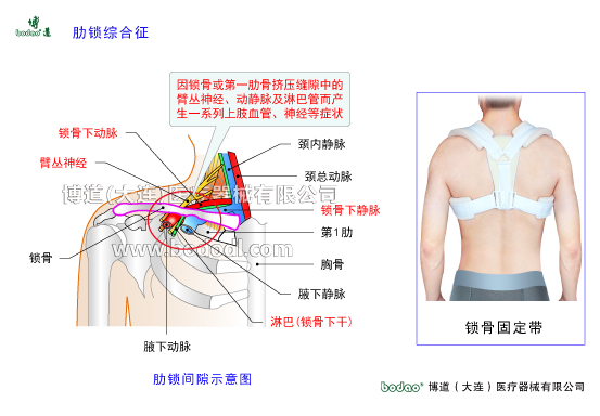 鎖骨的常見傷病與健康防護