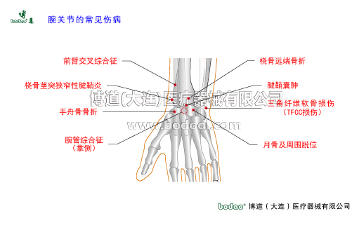 腕關(guān)節(jié)的常見(jiàn)疾病與健康防護(hù)