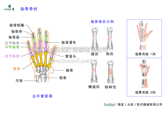 手關(guān)節(jié)常見傷病與健康防護