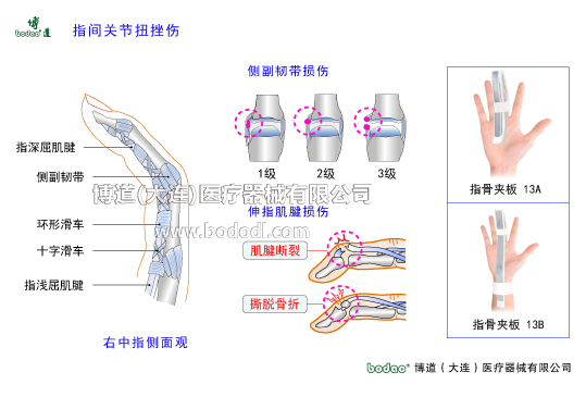 手關(guān)節(jié)常見傷病與健康防護
