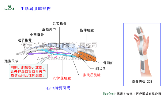 手關(guān)節(jié)常見傷病與健康防護