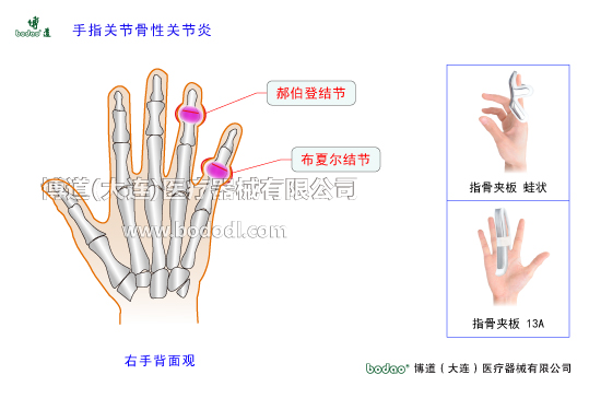 手關(guān)節(jié)常見傷病與健康防護