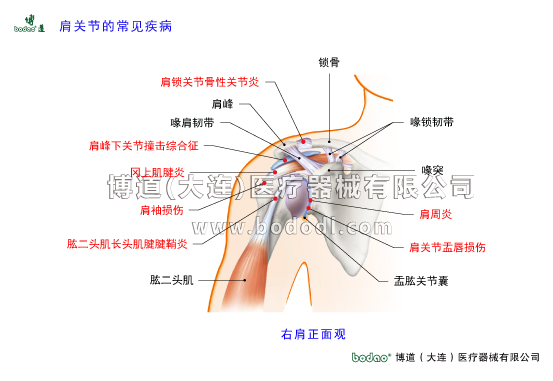 肩關(guān)節(jié)的常見疾病與健康防護(hù)