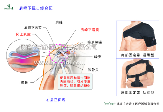 肩關(guān)節(jié)的常見疾病與健康防護(hù)