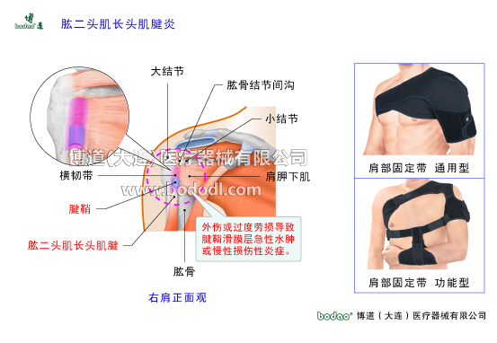 肩關(guān)節(jié)的常見(jiàn)疾病與健康防護(hù)