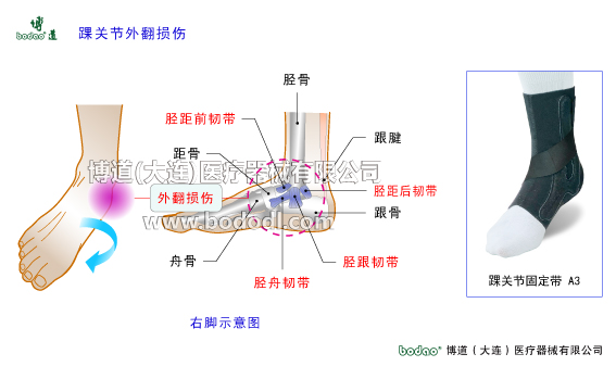 踝關(guān)節(jié)的構(gòu)造與常見傷病