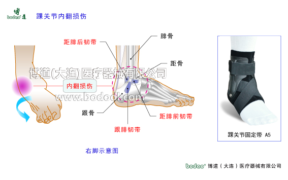 踝關(guān)節(jié)的構(gòu)造與常見(jiàn)傷病