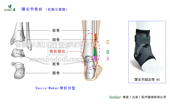 踝關(guān)節(jié)的構(gòu)造與常見傷病