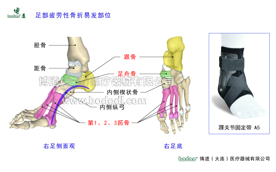 踝關(guān)節(jié)的構(gòu)造與常見傷病