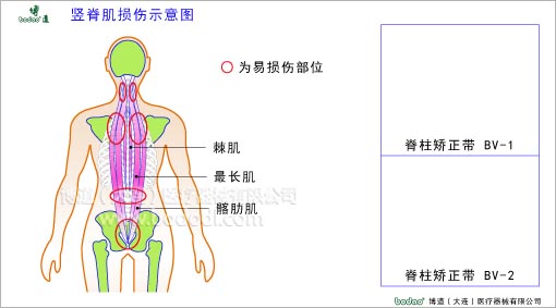 脊椎部疾病與健康護(hù)理