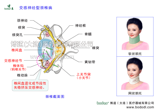 交感神經(jīng)型頸椎病的發(fā)病原因與癥狀頸椎綜合癥的預(yù)防與治療博道頸椎固定帶與矯正帶種類和功能頸椎間盤突出頸椎節(jié)段失穩(wěn)擠壓交感神經(jīng)頸神經(jīng)橫突椎體前縱韌帶交感神經(jīng)節(jié)椎體鉤鉤椎關(guān)節(jié)椎動(dòng)脈上關(guān)節(jié)突頸椎小關(guān)節(jié)黃韌帶棘突脊髓神經(jīng)根透氣圍領(lǐng)護(hù)頸頸椎矯正固定支架支具高度可調(diào)節(jié)頸椎矯正牽引固定帶頸椎術(shù)后康復(fù)矯正固定支具頸椎骨折急救固定支博道頸椎矯正帶脊髓神經(jīng)頸椎勞損頸椎不穩(wěn)