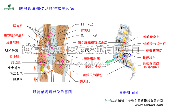腰椎部常見疾病腰背部疼痛部位腰椎部主要病癥腰椎解剖構造腰大肌腰方肌豎脊肌臀大肌臀中肌梨狀肌腹外斜肌背闊肌腰背部主要肌肉第三腰椎橫突綜合征背闊肌胸腰筋膜閃腰扭腰椎固定帶腰部固定帶醫(yī)用護腰肌勞損腰椎骨質增生腰背肌筋膜炎腰椎間盤突出胸腰椎壓縮性骨折腰椎椎管狹窄腰椎小關節(jié)紊亂腰椎滑脫分離癥腰椎峽部裂腰骶關節(jié)勞損骶髂關節(jié)炎腰椎結核馬尾神經綜合癥梨狀肌綜合征腰椎固定支具腰疼帶腰椎矯正固定牽引器腰椎病的預防與治療
