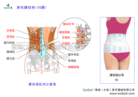 閃腰扭腰急性腰痛腰背筋膜損傷的主要癥狀與康復治療博道腰部固定帶醫(yī)用護腰急性腰扭傷易發(fā)部位，可分為豎脊肌損傷、多裂肌損傷、髂腰肌扭傷，棘上韌帶損傷，棘間韌帶損傷，胸腰深筋膜淺筋膜損傷，關節(jié)突關節(jié)損傷腰椎小關節(jié)損傷，腰骶關節(jié)損傷等。腰背部肌肉拉傷腰背部肌肉構造腰大肌腰方肌豎脊肌多裂肌橫突間肌回旋肌腹外斜肌腹內斜肌腹橫肌背闊肌胸腰筋膜腰椎間盤破裂腰椎骨裂骨折腰椎椎管狹窄腰椎小關節(jié)紊亂腰椎滑脫分離癥腰椎峽部