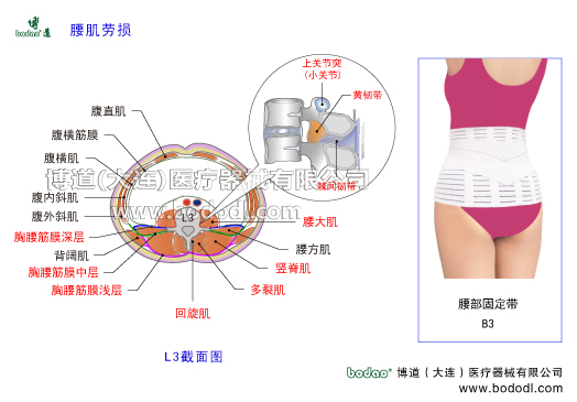 腰肌勞損慢性腰痛腰背肌筋膜炎功能性腰痛腰部軟組織損傷慢性腰痛的主要癥狀與治療博道腰部固定帶日本透氣性醫(yī)用護腰骶部軟組織慢性損傷豎脊肌腰大肌多裂肌腰背筋膜深層中層淺層腰扭傷腰椎部肌肉結構解剖腰方肌豎脊肌橫突間肌回旋肌腹外斜肌腹內斜肌腹橫肌背闊肌胸腰筋膜的功能腰椎骨質增生腰椎間盤突出腰椎壓縮性骨折腰椎小關節(jié)紊亂腰骶關節(jié)勞損骶髂關節(jié)炎腰椎固定帶護腰帶腰圍腰托腰椎固定矯正牽引支具腰椎固定支具腰痛帶博道護腰透