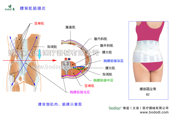 腰背肌筋膜炎的發(fā)病原因及癥狀，腰背肌筋膜炎的保守治療與手術治療。腰背肌筋膜炎的日常防護與治療方法。腰背肌筋膜又稱胸腰筋膜，由縱行的結締組織纖維編織而成，分淺層筋膜、中層筋膜和深層筋膜。博道腰部固定帶透氣性醫(yī)用護腰的功能與防護作用。腰背肌筋膜與肌肉的構造，胸腰筋膜的構造及功能與作用。第三腰椎截面圖和解剖構造圖，腰背部神淺層肌肉構造。閃腰扭腰等急性腰痛與慢性腰肌勞損，腰椎小關節(jié)紊亂椎間盤突出骨質增生腰椎