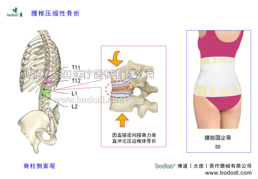 胸腰椎壓縮性骨折的發(fā)生原因、癥狀及治療。胸腰段壓縮性骨折的主要原因一是因間接暴力致傷及老年人骨質疏松或肌肉瞬間強力收縮等所造成的創(chuàng)傷，二是因直接暴力致傷。另外，骨結核、骨腫瘤等疾病也可導致椎骨壓縮性骨折。博道腰椎固定帶透氣性醫(yī)用護腰的功能與防護作用。胸腰椎壓縮性骨折的易發(fā)部位及保守治療和手術治療方法。為什么胸腰段容易發(fā)生椎體壓縮性骨折。日本透氣性護腰帶腰椎部骨折支具，博道透氣性醫(yī)用腰部固定帶