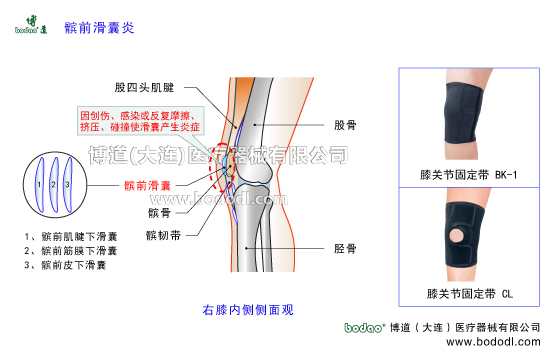 髕前滑囊炎膝關(guān)節(jié)滑囊炎的病因癥狀及防護(hù)與治療。膝關(guān)節(jié)滑囊的構(gòu)造與功能作用。博道膝關(guān)節(jié)透氣性加壓固定帶的功能與防護(hù)效果，醫(yī)用加壓護(hù)膝，滑囊炎專用加壓固定護(hù)膝，透氣性保暖保健護(hù)膝。右膝內(nèi)側(cè)側(cè)面觀膝關(guān)節(jié)的構(gòu)造。股四頭肌腱髕前滑囊髕韌帶髕前肌腱下滑囊髕前筋膜下滑囊髕前皮下滑囊。醫(yī)用護(hù)膝BK-1透氣性膝關(guān)節(jié)固定帶CL-1可調(diào)式膝關(guān)節(jié)卡盤固定支架矯形支具膝關(guān)節(jié)術(shù)后康復(fù)固定夾板膝關(guān)節(jié)共有11個(gè)滑囊是全身關(guān)節(jié)中滑囊