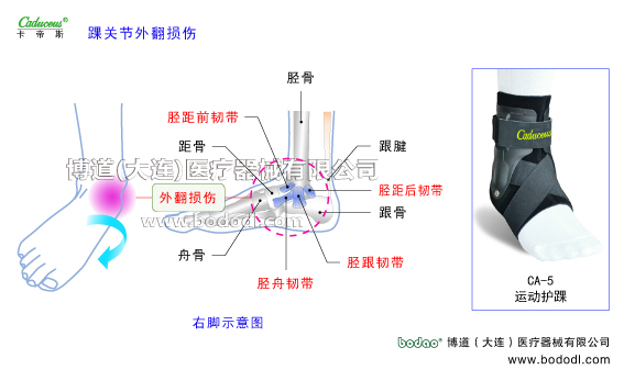 踝關節(jié)的運動損傷與防護