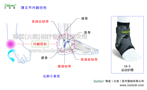 踝關節(jié)的運動損傷與防護