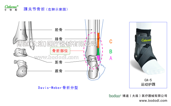 踝關節(jié)的運動損傷與防護