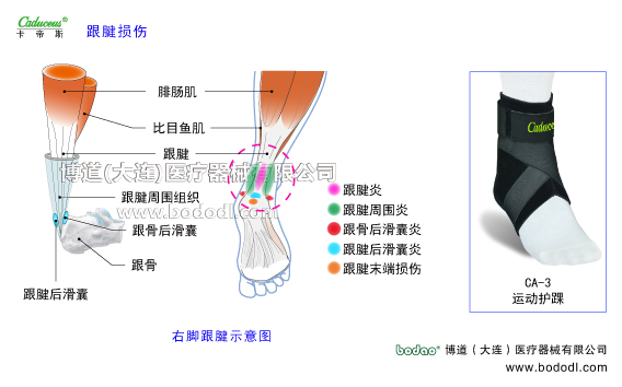 踝關節(jié)的運動損傷與防護