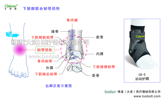 踝關(guān)節(jié)的運(yùn)動損傷與防護(hù)