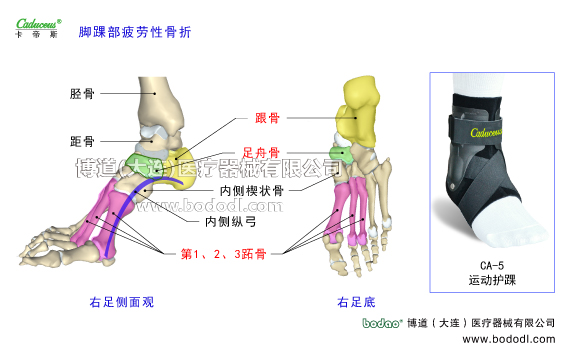 踝關節(jié)的運動損傷與防護