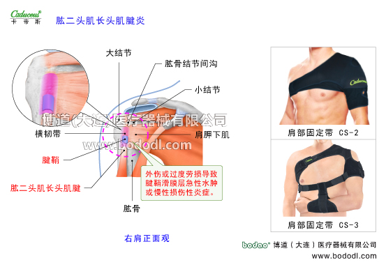 肩關(guān)節(jié)的運動損傷與防護