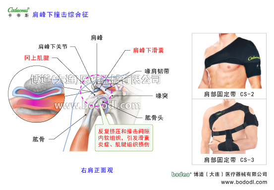 肩關(guān)節(jié)的運動損傷與防護
