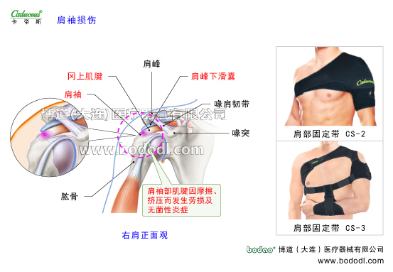 肩關(guān)節(jié)的運動損傷與防護