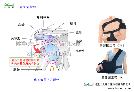 肩關(guān)節(jié)的運動損傷與防護