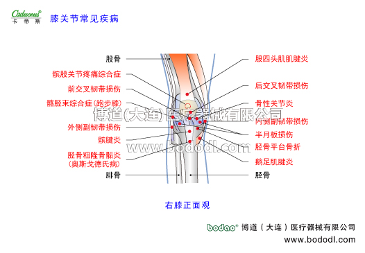 膝關(guān)節(jié)的運(yùn)動損傷與防護(hù)