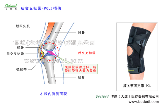 膝關(guān)節(jié)的運(yùn)動(dòng)損傷與防護(hù)