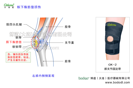 膝關(guān)節(jié)的運(yùn)動(dòng)損傷與防護(hù)