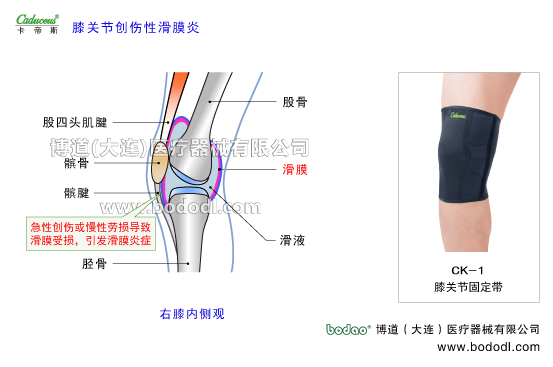 膝關(guān)節(jié)的運(yùn)動(dòng)損傷與防護(hù)