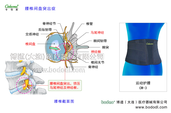 腰椎部的運(yùn)動損傷與防護(hù)