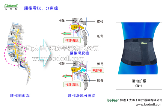 腰椎部的運(yùn)動損傷與防護(hù)