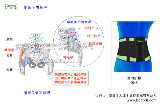 腰椎部的運(yùn)動損傷與防護(hù)