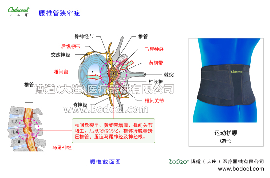 腰椎部的運(yùn)動損傷與防護(hù)