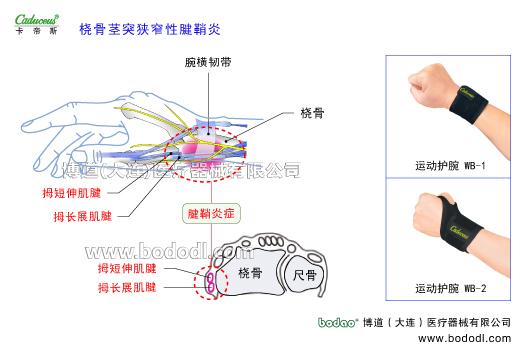 腕關(guān)節(jié)的運動損傷與防護