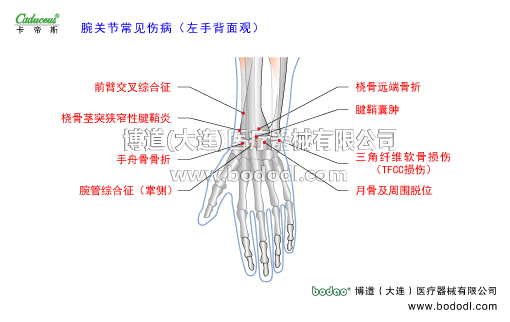 腕關(guān)節(jié)的運動損傷與防護