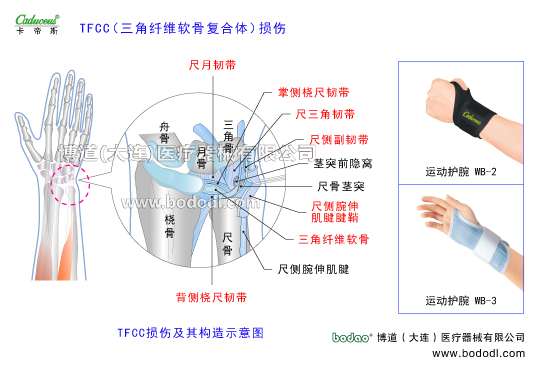 腕關(guān)節(jié)的運動損傷與防護