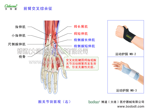 腕關(guān)節(jié)的運動損傷與防護