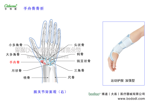 腕關(guān)節(jié)的運動損傷與防護