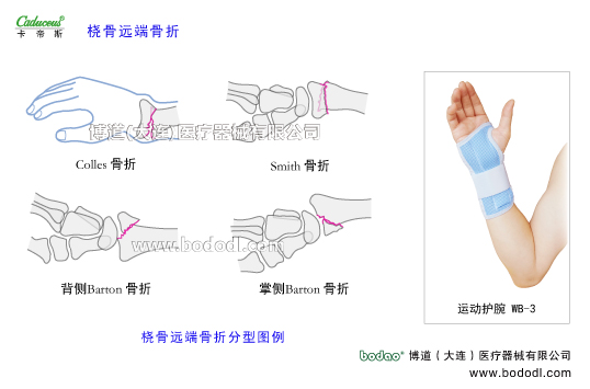 腕關(guān)節(jié)的運動損傷與防護