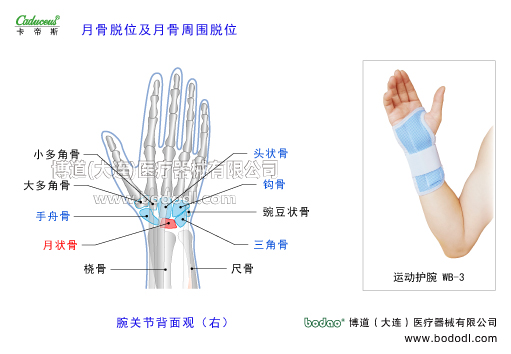 腕關(guān)節(jié)的運動損傷與防護