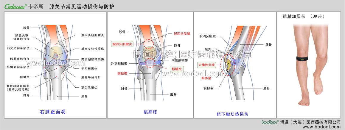MAJOR SPORTS INJURY OF KNEE JOINT 