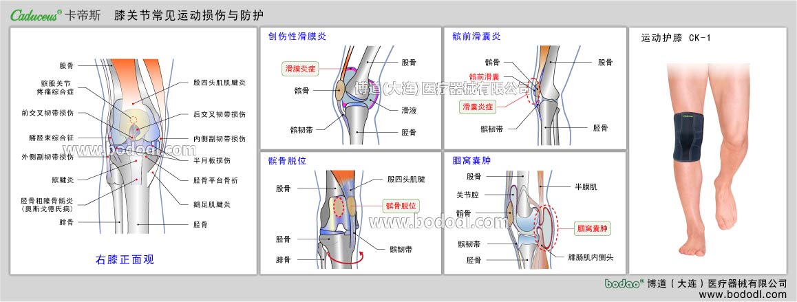 MAJOR SPORTS INJURY OF KNEE JOINT 