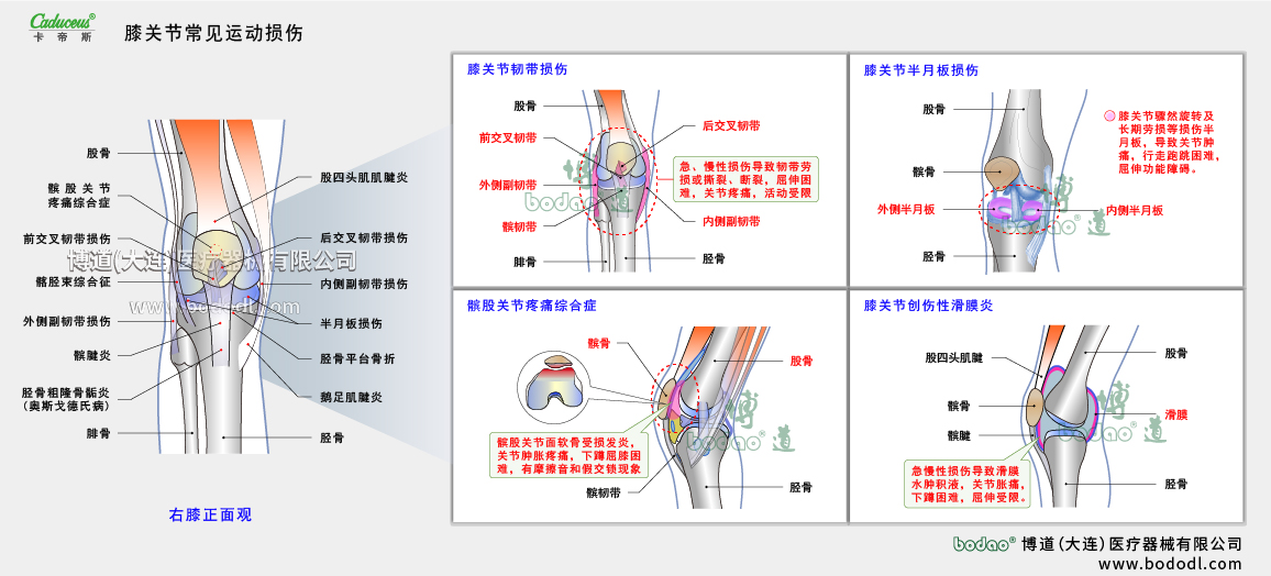 膝關(guān)節(jié)運(yùn)動(dòng)損傷的類(lèi)型與癥狀